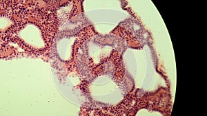 Glandular epithelium, microscopic photo of permanent preparation