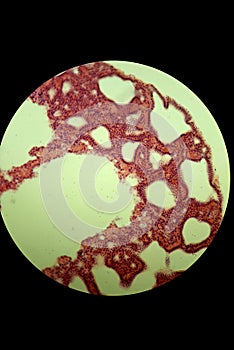 Glandular epithelium, microscopic photo of permanent preparation