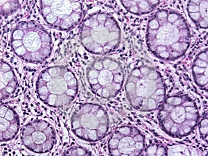 Glandular Tissue