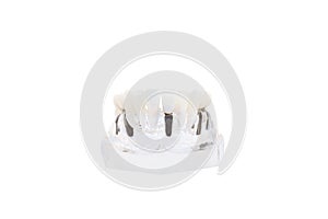 Glass jaw model with implanted dentures