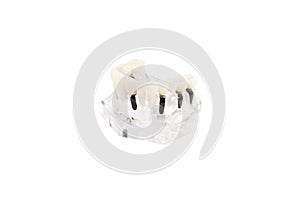 Glass jaw model with implanted dentures