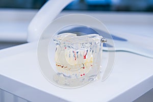 Glass jaw model with implanted dentures on the working dental table surface