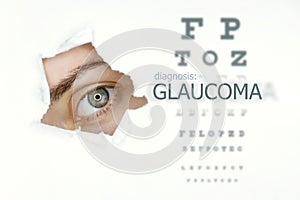 Glaucoma disease poster with eye test and blue eye on left.