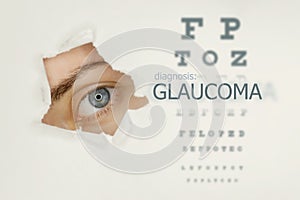 Glaucoma disease poster with eye test and blue eye on right