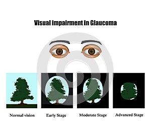  . de visión en. infografias. ilustraciones sobre el 