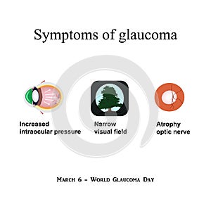 Glaucoma. Symptoms of glaucoma. Atrophy of the optic nerve. Field of view at glaukome.Stroenie eyes. Infographics.