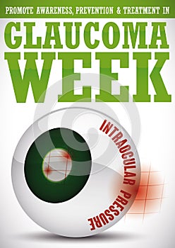 Glaucoma Week Design with Representation of this Sickness in Eyeball, Vector Illustration