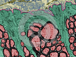 Glial limiting membrane