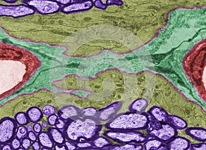 Glial limiting membrane