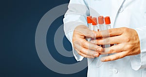 Global Research And Healthcare Concept. Doctor hands hold laboratory test tubes