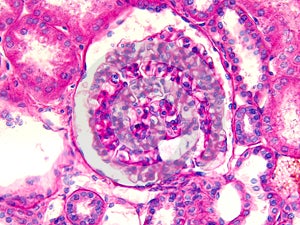 Microscopic photograph of a glomerulus in human kidney photo