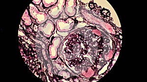 Glomerulus photo