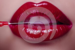 Glossy red crimson lips receiving a cosmetic filler injection with a syringe, a depiction of beauty trends and