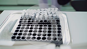 The gloved doctor takes the test tubes. Close-up of a scientist taking out a small test tube from a tripod. A sample of