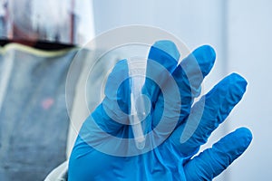 Gloved Hand with Coronavirus Swab Sample