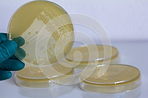 Gloved hand holding a Petri dish Bacteria