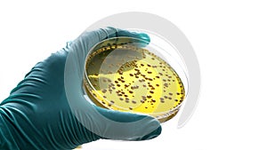 Gloved hand holding a Petri dish Bacteria culture