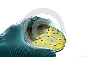Gloved hand holding a Petri dish Bacteria culture