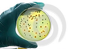 Gloved hand holding a Petri dish Bacteria culture