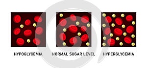 Glucose Blood Sugar Level Set. Hypoglycemia and Hyperglycemia Icons. Vector photo