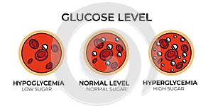 Glucose blood sugar test. Hypoglycemia or hyperglycemia insulin diabetes diagram icon