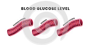 Glucose in blood vessel. glucose level, hyperglycemia hypoglycemia blood and sugar stream at blood