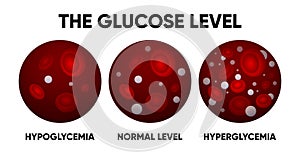Glucose in the blood vessel. Normal levels, hyperglycemia, hypoglycemia. Normal, high and low blood sugar. Blood diagram
