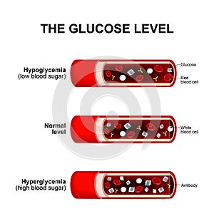Glucose level