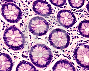 Goblet cells. LieberkÃÂ¼hn`s crypts photo