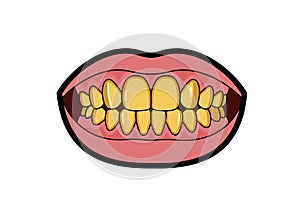 Gold teeth clipart