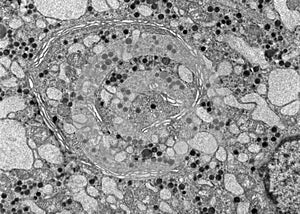 Golgi apparatus. Gonadotropic cell. TEM photo