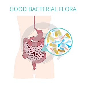 Good bacterial flora. Lactobacilli, bifidobacteria, Escherichia