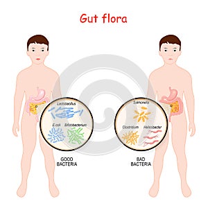 Good and Bad Bacteria. Gut flora of children. Kids with intestines and different forms of bacteria