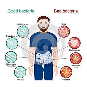 Good and bad bacteria. Poster about probiotics photo