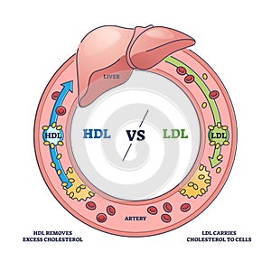Good HDL and bad LDL cholesterol movement comparison outline diagram photo