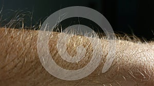 Goose bumps close up arm hairs standing up
