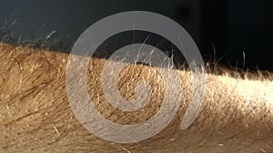 Goosebumps close up arm hairs standing up