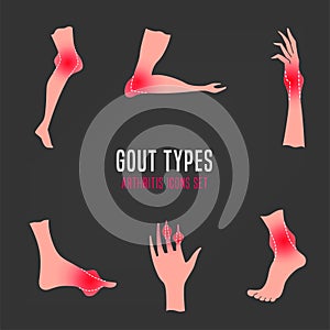 Gout arthritis icon