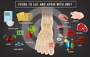 Gout arthritis infographic