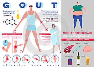 Gout arthritis infographic