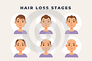 Gradient hair loss scheme Vector illustration.