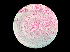 Gram negative bacillus. Gram stain.