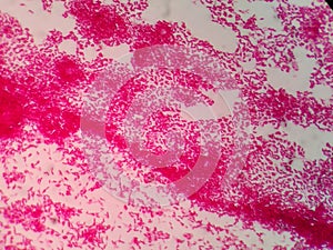 Gram negative bacillus. Gram stain.