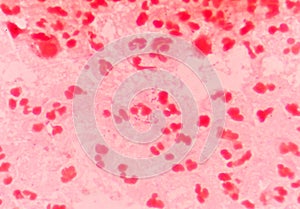 Gram negative diplococci intracellular