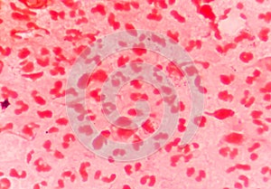 Gram negative diplococci intracellular