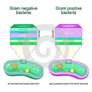 Gram negative and Gram positive bacteria photo