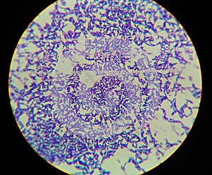Gram positive bacilli with spor forming.