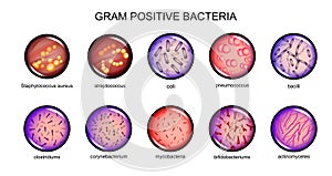 Gram positive bacteria photo