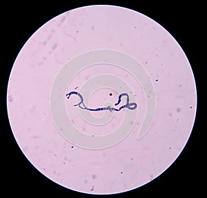 Gram positive cocci.