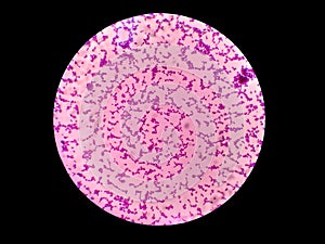 Gram positive cocci. Gram stain. photo